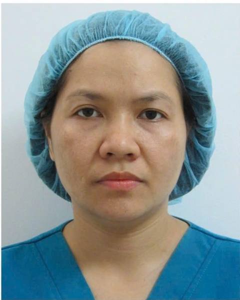 Before: A more toned-looking face