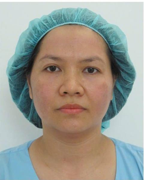 After: A more toned-looking face